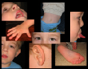 Galen Collage